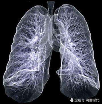 呼吸疾病状况和分类