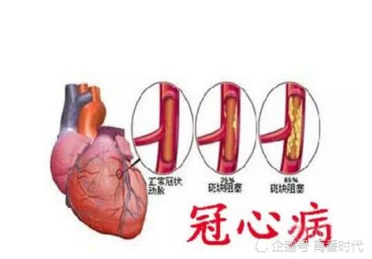 胸痛和肺部疾病的关联性不强